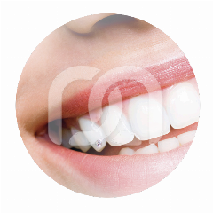 SKYCE CRISTAL DIA 1.9MM (5) SKYCE CRISTAL DIA 1.9MM (5)
