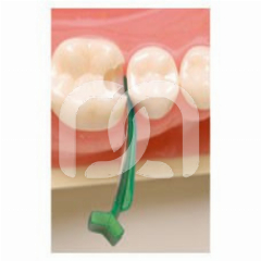 FENDERMATE - KIT ASSORTIMENT