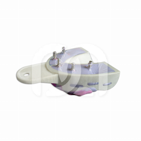 MIRATRAY IMPLANT - INTRODUCTIE KIT  MIRATRAY IMPLANT - INTRODUCTIE KIT