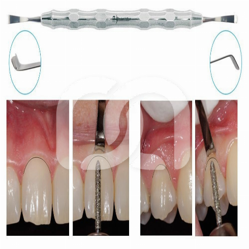 DUBBELZIJDIGE GINGIPROTECT-INSTRUMENT 3,7MM