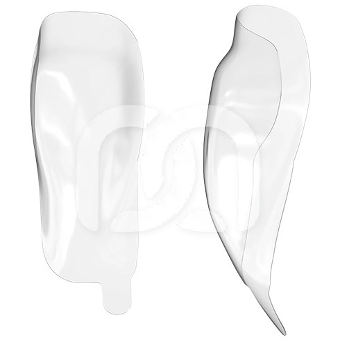 HD MATRIX - DIASTEMA CLOSURE (25)