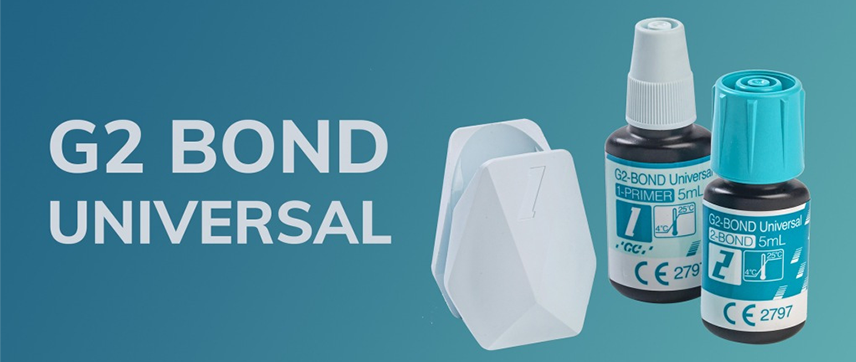 G2 BOND, VERS UN NOUVEAU STANDARD DE L'ADHÉSION