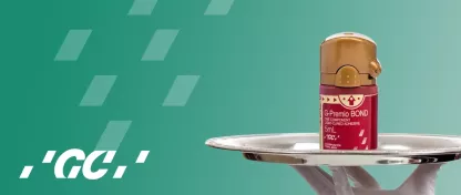 POURQUOI COLLER AVEC LE G-PREMIO BOND ?