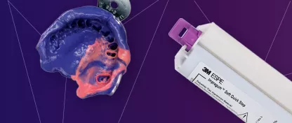 DES EMPREINTES D'IMPLANTS AVEC LE IMPREGUM™  SOFT QUICK STEP