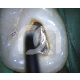 INSERTS START-X - INSERT NÂ°1 COMPATIBLE SATELEC