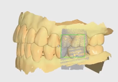 checklist-medit-rectangle-vert-dentition