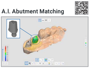 A.I. Abutment Matching